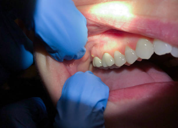 Best Emergency Dental Services for Seniors in East Grand Rapids, MI