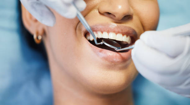 Best Emergency Dental Care for Abscessed Tooth in East Grand Rapids, MI