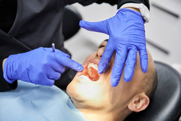 Best Emergency Root Canal Treatment in East Grand Rapids, MI